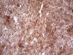 LAMA4 Antibody in Immunohistochemistry (Paraffin) (IHC (P))