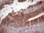 LAMA4 Antibody in Immunohistochemistry (Paraffin) (IHC (P))