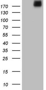 LAMA4 Antibody in Western Blot (WB)