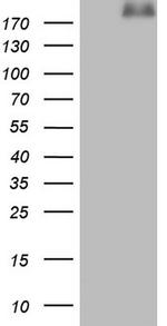 LAMA4 Antibody in Western Blot (WB)