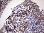 LAMB3 Antibody in Immunohistochemistry (Paraffin) (IHC (P))