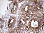 LAMB3 Antibody in Immunohistochemistry (Paraffin) (IHC (P))