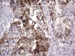 LAMB3 Antibody in Immunohistochemistry (Paraffin) (IHC (P))