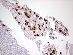 LAMB3 Antibody in Immunohistochemistry (Paraffin) (IHC (P))