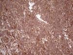 LAMB3 Antibody in Immunohistochemistry (Paraffin) (IHC (P))