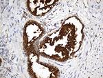 LAMP1 Antibody in Immunohistochemistry (Paraffin) (IHC (P))