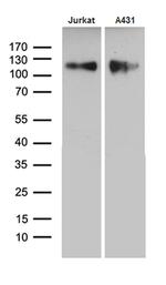 LAMP1 Antibody in Western Blot (WB)