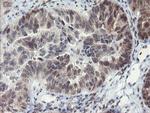 LANCL2 Antibody in Immunohistochemistry (Paraffin) (IHC (P))