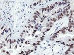 LANCL2 Antibody in Immunohistochemistry (Paraffin) (IHC (P))