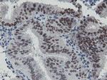 LANCL2 Antibody in Immunohistochemistry (Paraffin) (IHC (P))