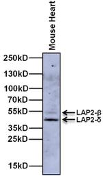 LAP2 Antibody in Western Blot (WB)