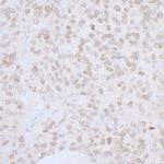 LAP2 alpha/TMPO Antibody in Immunohistochemistry (IHC)