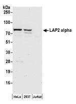 LAP2 alpha/TMPO Antibody in Western Blot (WB)