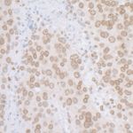 LAP2 alpha beta gamma/TMPO Antibody in Immunohistochemistry (IHC)