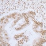 LAP2 alpha beta gamma/TMPO Antibody in Immunohistochemistry (IHC)