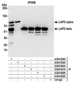 LAP2 alpha beta gamma/TMPO Antibody in Western Blot (WB)