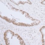 LAP2 beta/TMPO Antibody in Immunohistochemistry (IHC)