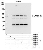 LAP2 beta/TMPO Antibody in Western Blot (WB)