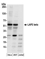 LAP2 beta gamma/TMPO Antibody in Western Blot (WB)