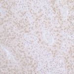 LAP2 beta gamma/TMPO Antibody in Immunohistochemistry (IHC)