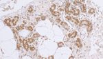 LAP2 beta gamma/TMPO Antibody in Immunohistochemistry (IHC)