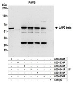 LAP2 beta gamma/TMPO Antibody in Western Blot (WB)