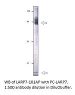 LARP7 Antibody in Western Blot (WB)