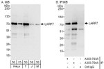 LARP7 Antibody in Western Blot (WB)