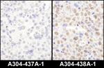 LAS1L Antibody in Immunohistochemistry (IHC)