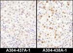 LAS1L Antibody in Immunohistochemistry (IHC)