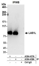 LAS1L Antibody in Immunoprecipitation (IP)