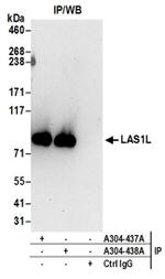 LAS1L Antibody in Western Blot (WB)