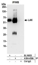 LAX Antibody in Western Blot (WB)