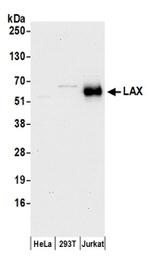 LAX Antibody in Western Blot (WB)