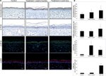 LCE1A Antibody in Immunohistochemistry (IHC)