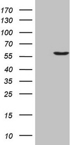 LCOR Antibody in Western Blot (WB)