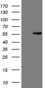 LCOR Antibody in Western Blot (WB)