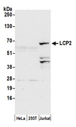 LCP2/SLP76 Antibody in Western Blot (WB)