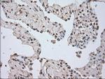 LDHA Antibody in Immunohistochemistry (Paraffin) (IHC (P))