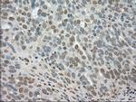 LDHA Antibody in Immunohistochemistry (Paraffin) (IHC (P))