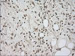 LDHA Antibody in Immunohistochemistry (Paraffin) (IHC (P))