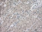 LDHA Antibody in Immunohistochemistry (Paraffin) (IHC (P))