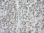 LDHA Antibody in Immunohistochemistry (Paraffin) (IHC (P))