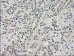 LDHA Antibody in Immunohistochemistry (Paraffin) (IHC (P))