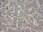 LDHA Antibody in Immunohistochemistry (Paraffin) (IHC (P))