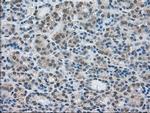 LDHA Antibody in Immunohistochemistry (Paraffin) (IHC (P))