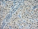 LDHA Antibody in Immunohistochemistry (Paraffin) (IHC (P))