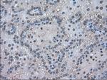 LDHA Antibody in Immunohistochemistry (Paraffin) (IHC (P))