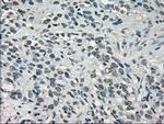 LDHA Antibody in Immunohistochemistry (Paraffin) (IHC (P))