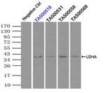 LDHA Antibody in Immunoprecipitation (IP)